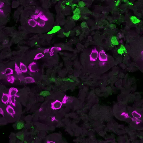 Gene Therapy Vectors