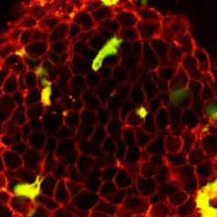 Islet Cell Islet Cell